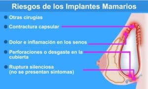 implantes de senos